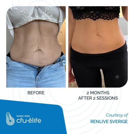 CFU-ELIFE_Before-After_01