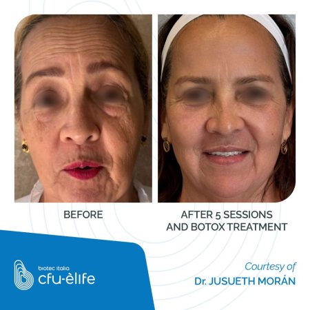 CFU-ELIFE_Before-After_22-1