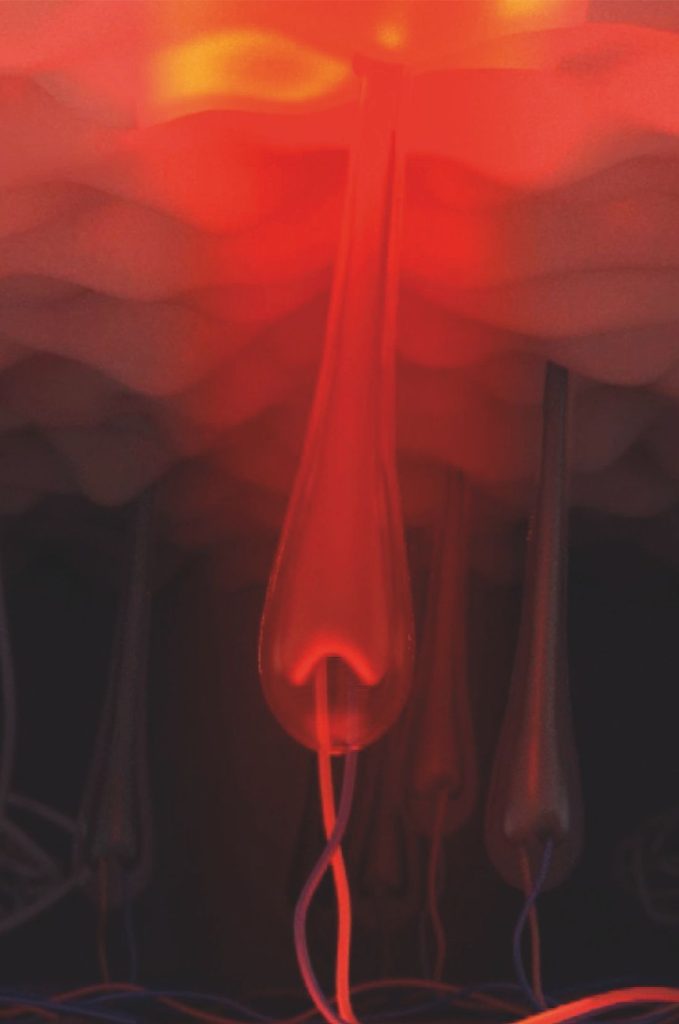 xlase-plus-biotec-italia-icespeed-alexpro